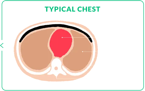 typical chest cross section