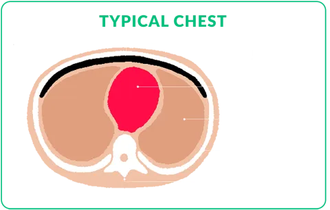 typical chest cross section